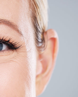 Crows Feet